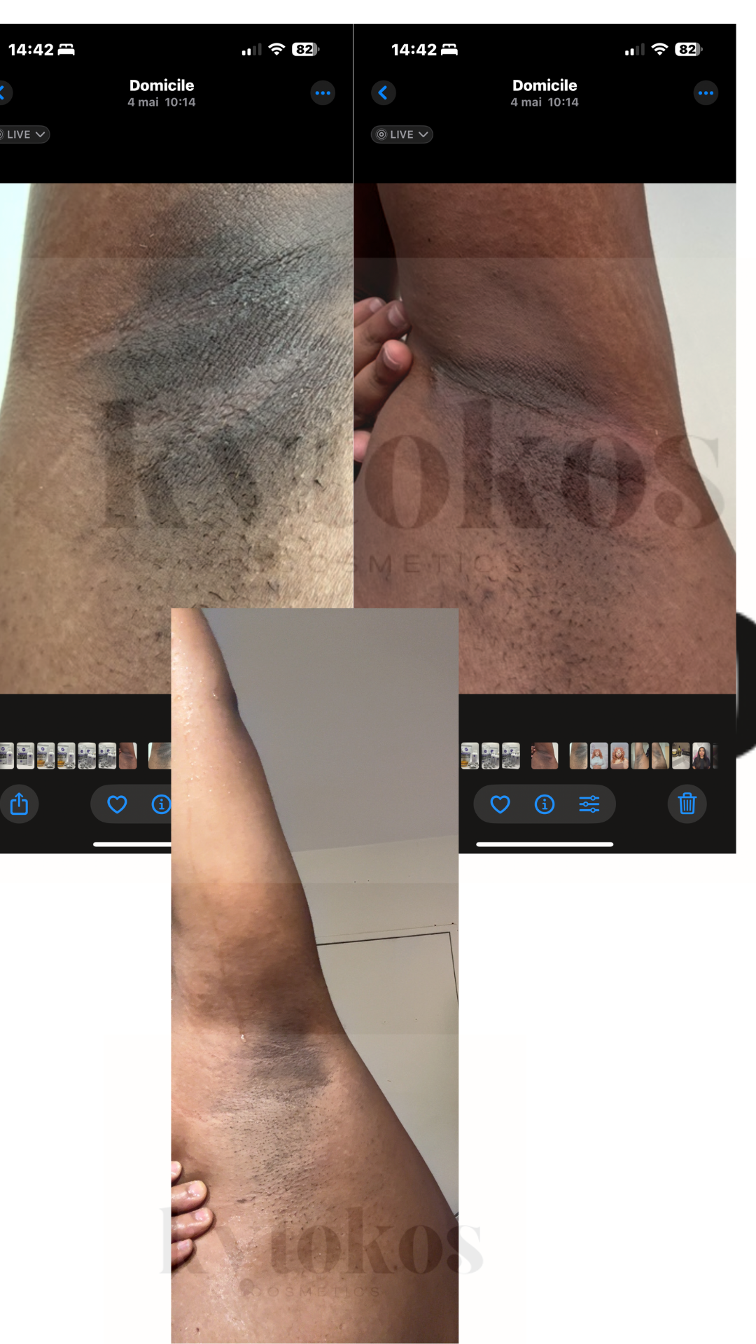 Gel zone sombres
